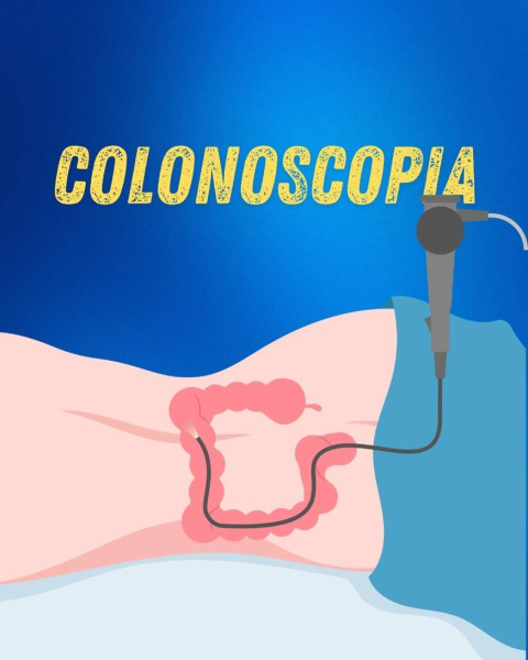 COLONOSCOPIA